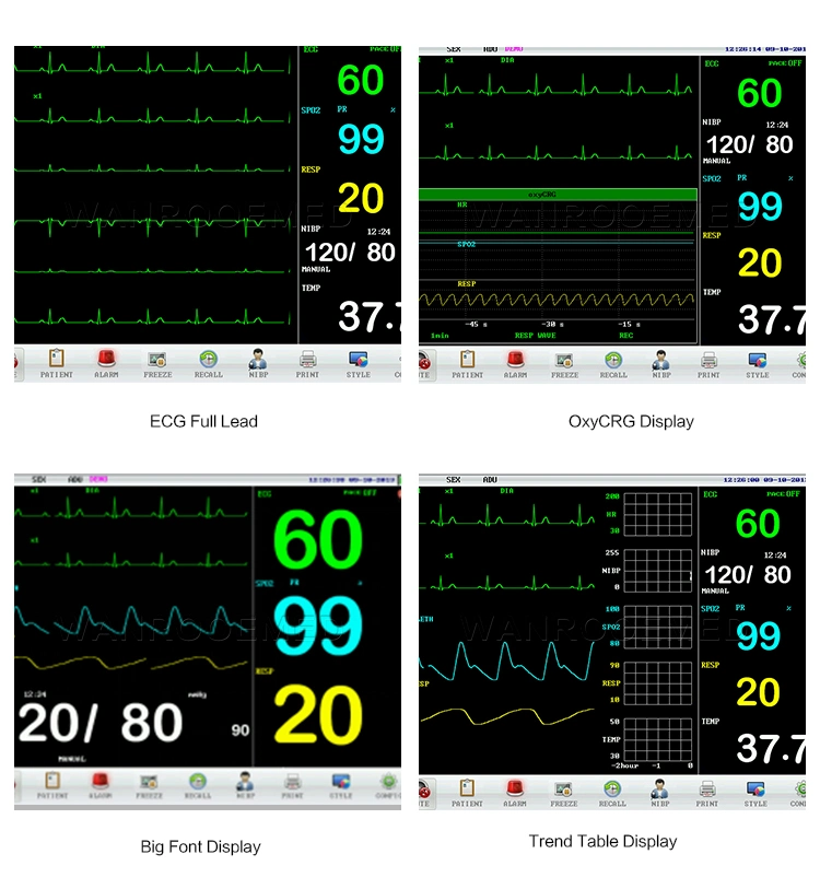 F8 Medical Portable ICU ECG Room Multi-Parameter 12.1 Inches Vital Signs Cardiac Patient Digital Blood Pressure Monitor